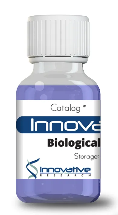 Cathepsin B Recombinant Protein His Tag Lyophilized