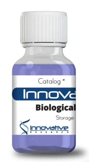 Cathepsin B Recombinant Protein His Tag Lyophilized