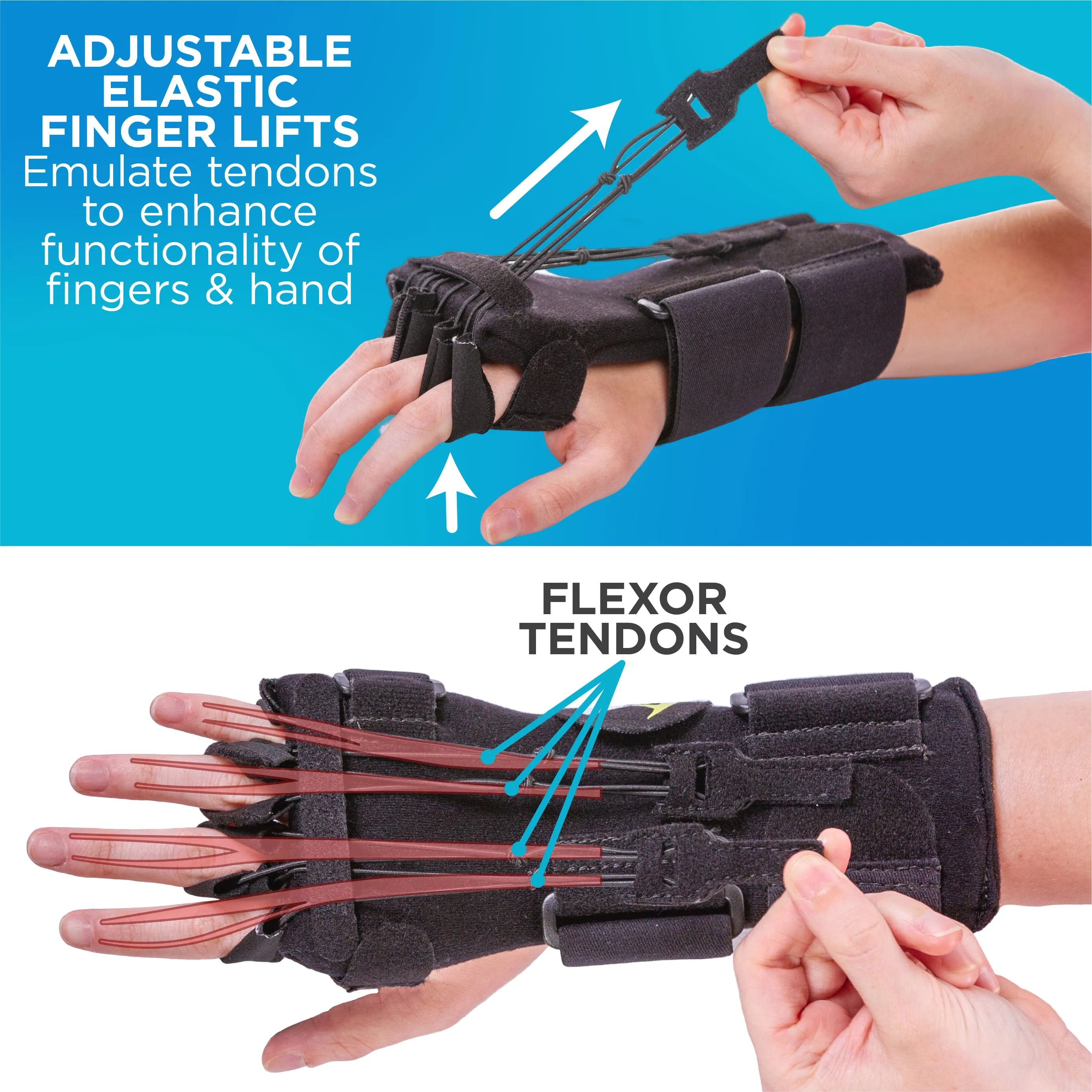 Radial Nerve Palsy Splint | Dynamic Wrist Drop & Finger Extension Brace for Saturday Night, Honeymoon & Crutch Palsy